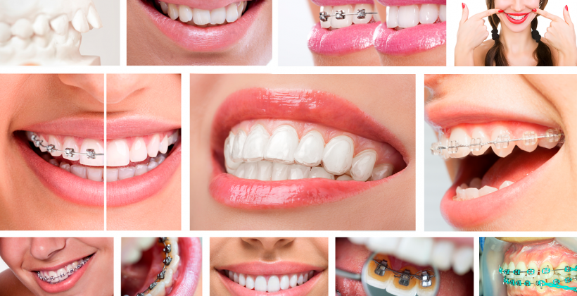 AS PRINCIPAIS DIFERENÇAS ENTRE OS APARELHOS FIXOS